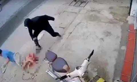 Người đàn ông bị chém đứt lìa chân khi đang đi bộ trên đường