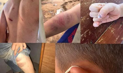 Khởi tố cha và bà nội bạo hành cháu bé 9 tuổi ở Đắk Lắk