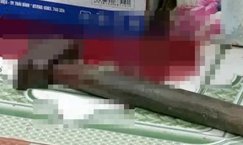 Nam nhân viên dùng búa tấn công con gái chủ quán vì bị từ chối tình cảm
