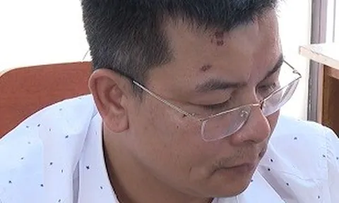 Thanh Hóa: Khởi tố, bắt tạm giam đối tượng dí thuốc lá vào mặt công an