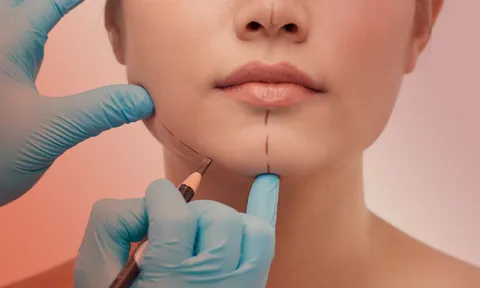 Phẫu thuật thẩm mỹ có phải làm lại thẻ căn cước công dân?