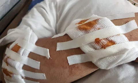 Điều tra nhóm đối tượng chém người đi đường lúc rạng sáng ở Hà Nội