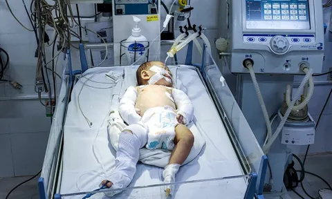 Lâm Đồng: Bắt nghi phạm bạo hành con gái 2 tháng tuổi của người tình