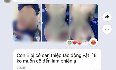 Hà Nội: Xác minh thông tin cháu bé 9 tuổi nghi bị cô giáo dạy can thiệp bạo hành