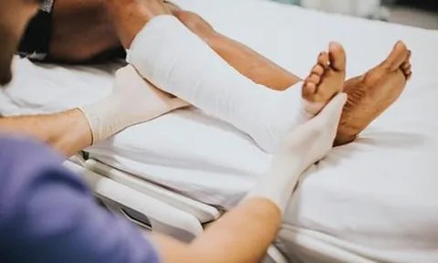 Xác định tỉ lệ phần trăm thương tật trong vụ án hình sự