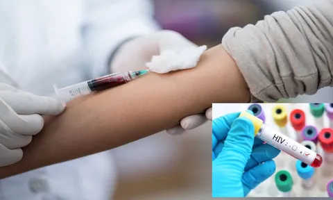Quy định mới nhất về điều kiện xác định người nhiễm HIV do tai nạn rủi ro nghề nghiệp