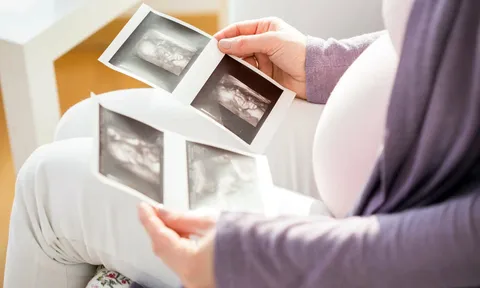 Bộ Y tế đề xuất phạt đến 100 triệu đồng nếu lựa chọn giới tính thai nhi
