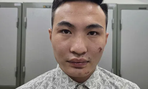 Tạm giữ nam thanh niên vi phạm giao thông, chống người thi hành công vụ