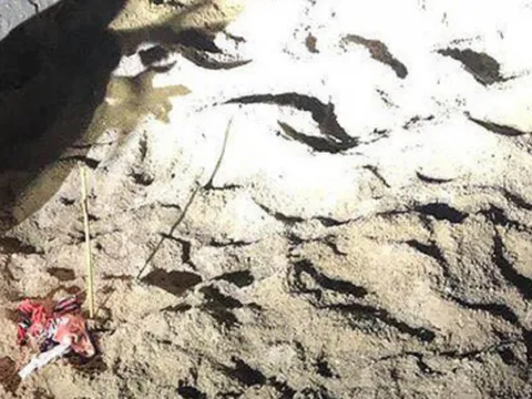 Bé trai bị gần chục con chó cắn xé ở Hưng Yên đã tử vong