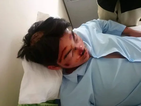 Nam sinh lớp 11 bị 3 thanh niên cùng trường chém nhập viện