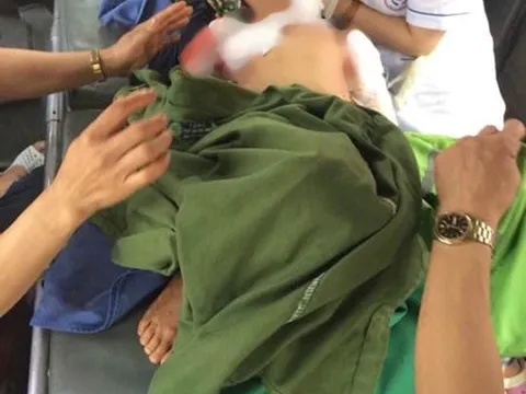 Bé trai 7 tuổi ở Thái Nguyên bị chó nhà nuôi cắn tử vong