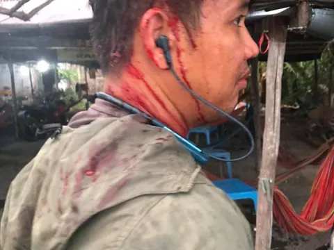 'Chặt chém' giá 2 chai nước ngọt, người đàn ông bị chủ quán đánh nhập viện