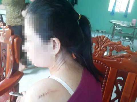 Tình hình sức khỏe các nạn nhân trong vụ cô dâu bị chồng cũ chém trong ngày cưới?