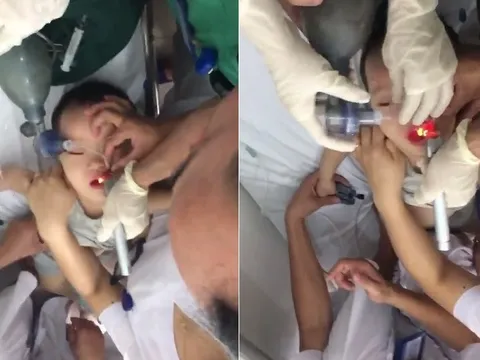 Hóc thạch rau câu, bé trai 2 tuổi ngưng thở