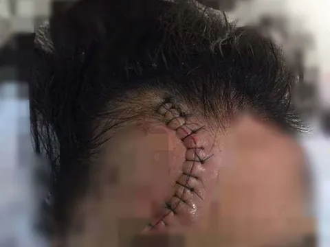 Truy tìm ôtô Mazda CX5 đâm cô gái rồi bỏ chạy ở Cầu Giấy