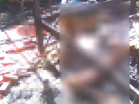 Tức giận vì thường xuyên bị bạo hành, người phụ nữ tưới xăng đốt chồng