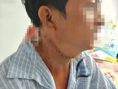 Bắt giữ nghi phạm cứa cổ tài xế xe ôm công nghệ ở TP.HCM