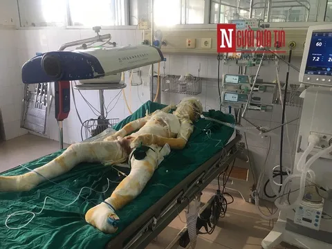 Nạn nhân thứ 4 tử vong trong vụ phóng hỏa giết người ở Sơn La