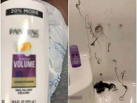 Không cần động tay đánh ghen, vợ vẫn khiến kẻ thứ 3 phải trọc đầu nhờ chiêu độc