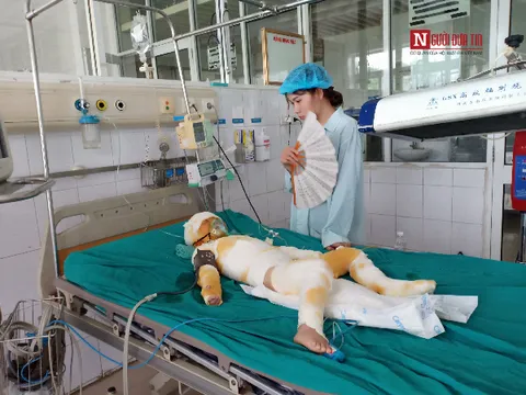 Tình hình sức khỏe của 3 bé bị bỏng cồn tại lớp trẻ mầm non