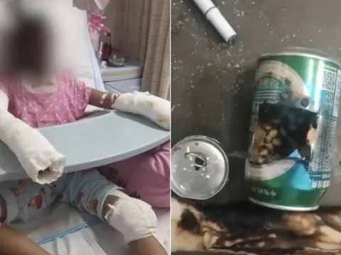 Bé gái 14 tuổi thiệt mạng sau khi bắt chước cách làm bỏng ngô trên mạng