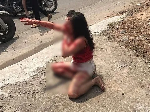 Nữ tiếp viên quán cà phê bị chồng hờ rạch mặt tàn ác