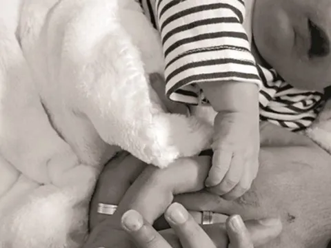 Đình chỉ bác sĩ siêu âm cho bé trai chào đời không có mắt mũi