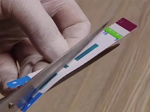 Bộ Y tế vào cuộc về vụ việc nhân viên cắt đôi que xét nghiệm HIV, viêm gan B tại bệnh viện Xanh Pôn