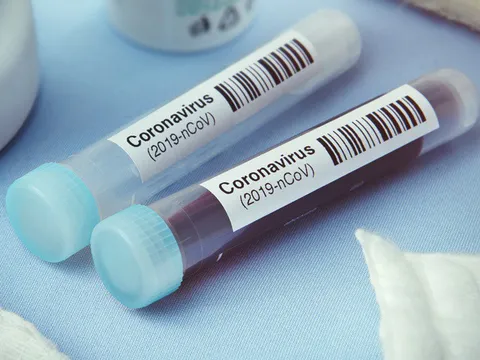 Hà Nội bắt đầu xét nghiệm nhanh Covid-19 trên diện rộng