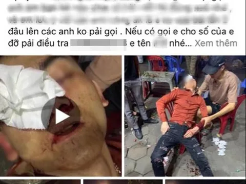 Vụ CSGT bị tố vụt dùi cui vào người đi xe máy: Công an Vĩnh Phúc lên tiếng