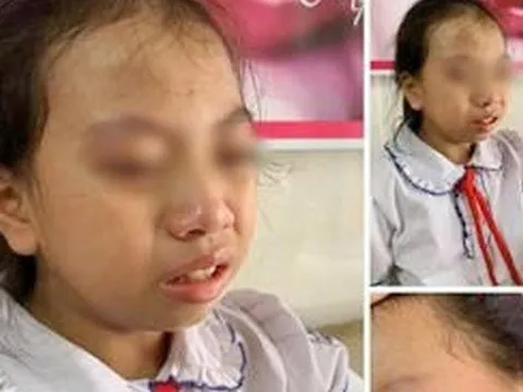 Đình chỉ cô giáo tát học sinh lớp 4 tại Hà Giang