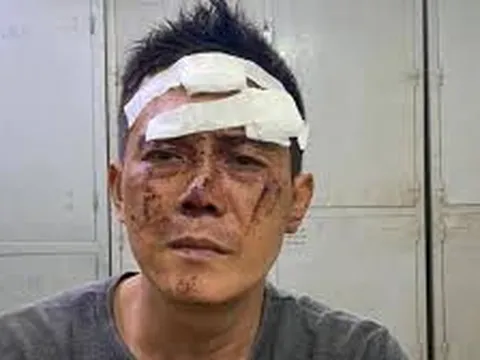 TP.HCM: Khống chế con nghiện dùng kim tiêm uy hiếp để cướp tài sản