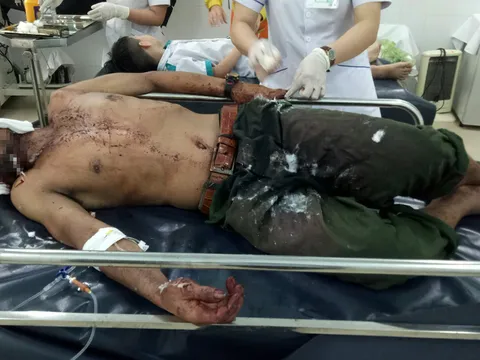 Người đàn ông bị gấu rừng tấn công khi đi thăm vườn sâm