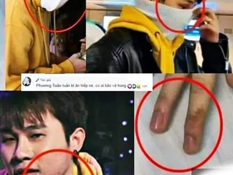 Lộ nghi vấn Jack bị hành hung, K-ICM nhắn tin đe dọa