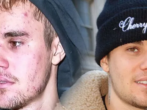 Justin Bieber tiết lộ cùng lúc anh bị mắc hai căn bệnh vô cùng đáng sợ