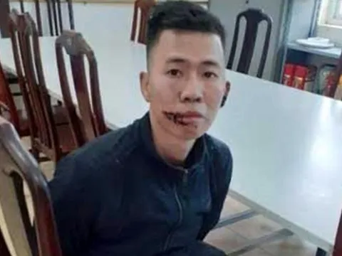 Giám định tâm thần nam thanh niên chém cả gia đình thương vong ở Hà Nội