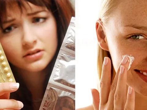 Thuốc tránh thai - bạn đồng minh của nám, bạn có biết?