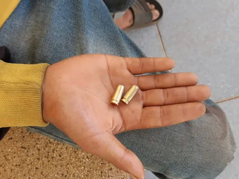 Xác minh vụ công an xã nổ súng làm 2 người trúng đạn