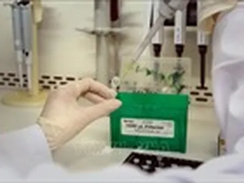 Các trường hợp F1 liên quan đến Công ty Xi măng Hoàng Thạch xét nghiệm âm tính lần 1