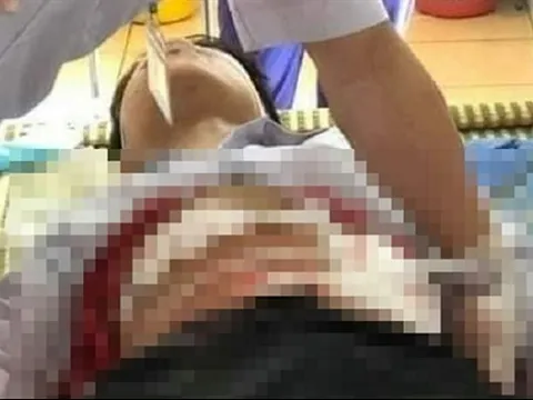 Mâu thuẫn trong lúc trêu đùa, nam sinh lớp 9 lấy dao đâm bạn