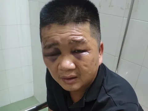 Tạm giữ đối tượng móc cốp xe trộm 100 triệu đồng