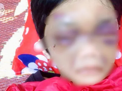 Khởi tố người mẹ hành hạ dã man con gái ruột ở Hải Dương