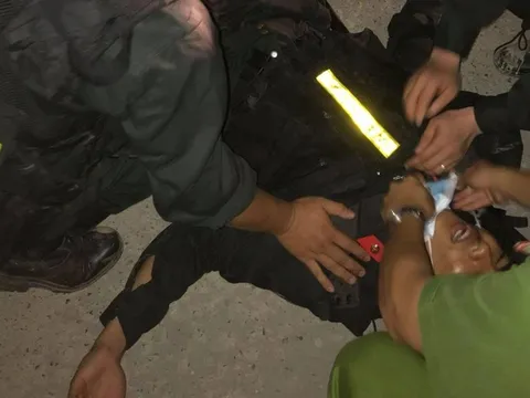 Bắt tạm giam 4 côn đồ tấn công cảnh sát bảo vệ xe vận chuyển thiết bị điện gió