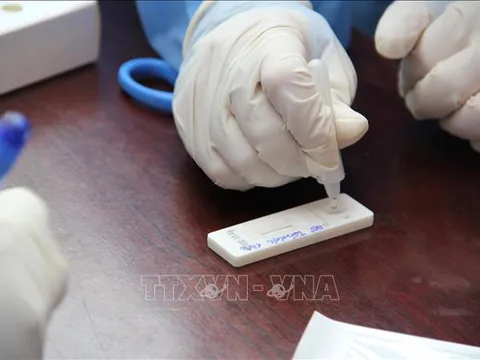 Ngày 27/10, Việt Nam ghi nhận 4.411 ca nhiễm mới SARS-CoV-2; tăng so với ngày trước đó