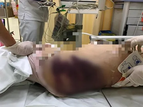 TP.HCM: Bắt khẩn cấp dì ghẻ nghi bạo hành bé 8 tuổi đến tử vong