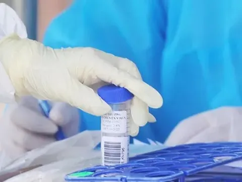 Ngày 1/3: Số mắc mới COVID-19 cả nước lần đầu lên đến 98.762 ca; Hà Giang bổ sung hơn 15.000 F0