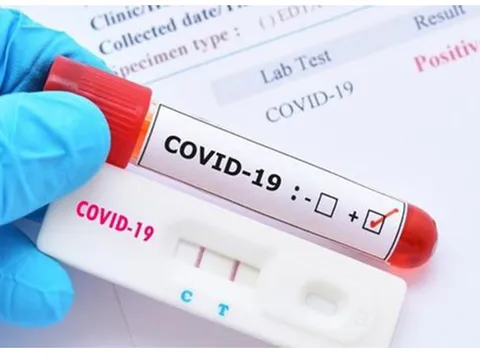 Cơ sở y tế tư nhân không được lợi dụng dịch bệnh để tăng giá xét nghiệm COVID-19