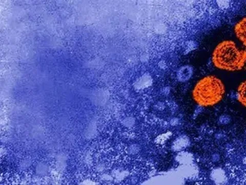 Bộ Y tế: Theo dõi chặt chẽ bệnh viêm gan cấp tính 'bí ẩn' ở trẻ, báo cáo ngay trường hợp bất thường