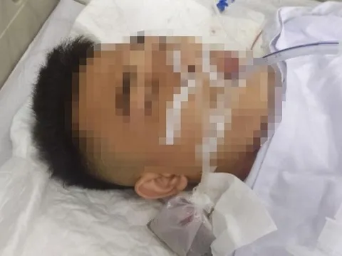 Nhóm côn đồ nổ súng vào nhà dân, bắn một người trọng thương ở Hải Phòng