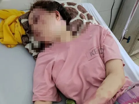 Tạm đình chỉ công tác cán bộ Cục QLTT Thanh Hóa bị ‘tố’ đánh đập bạn gái